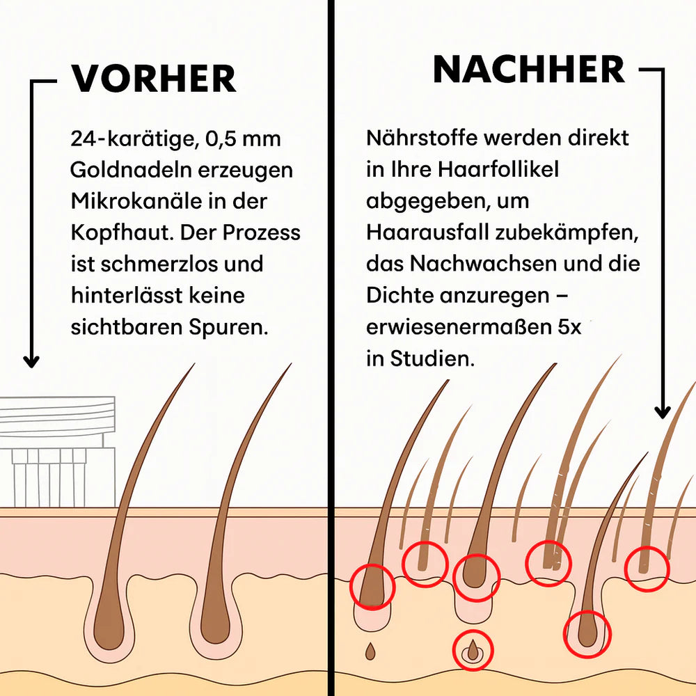 AlphaDrops™ Volle Haare in 30 Tagen