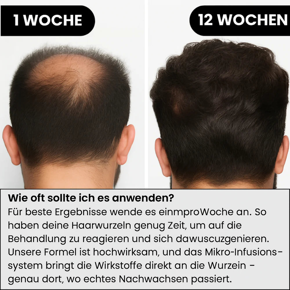 AlphaDrops™ Volle Haare in 30 Tagen