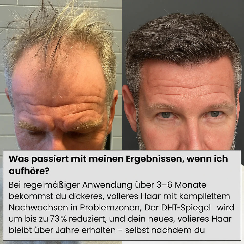 AlphaDrops™ Volle Haare in 30 Tagen